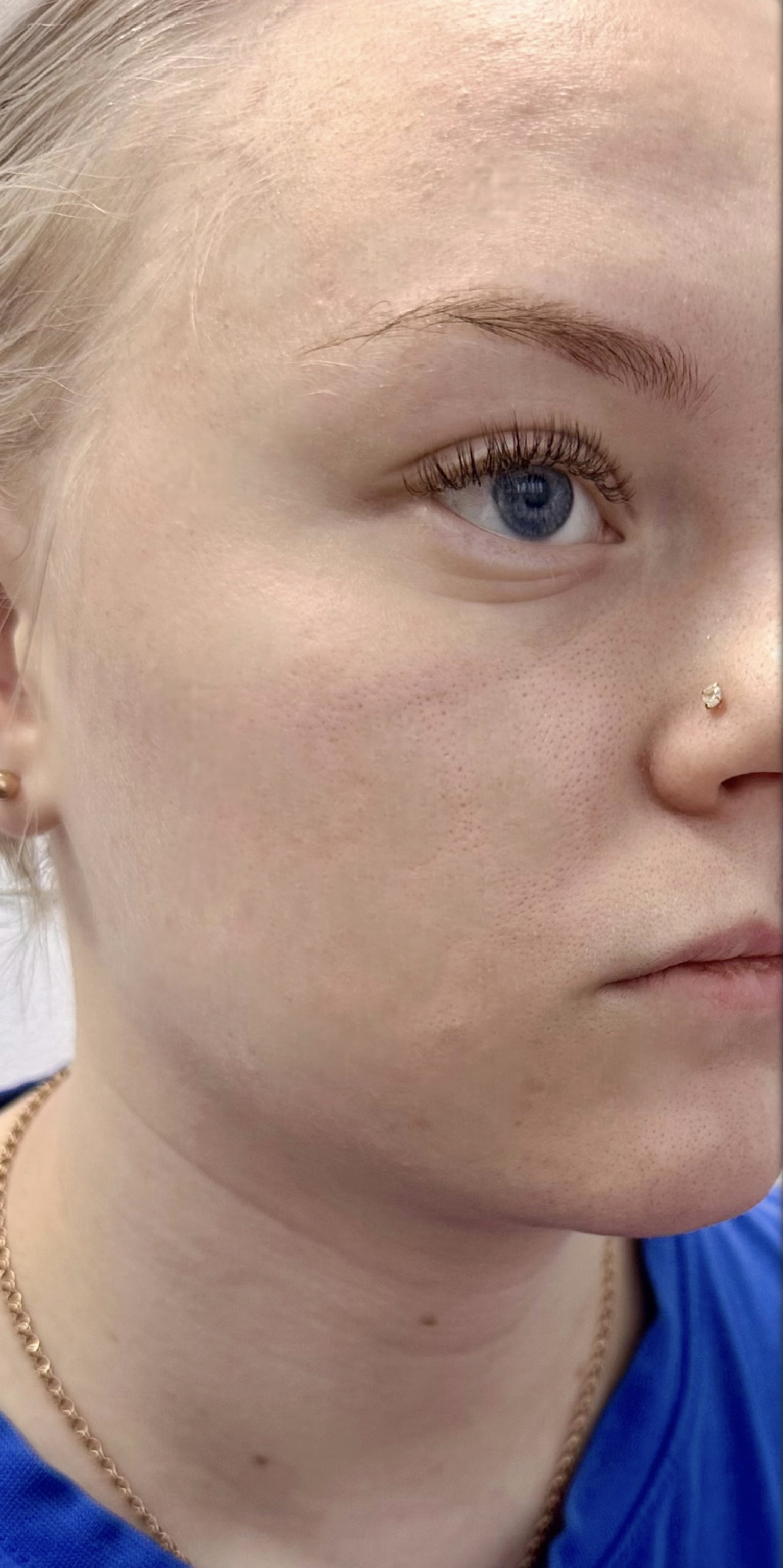 Фото услуги