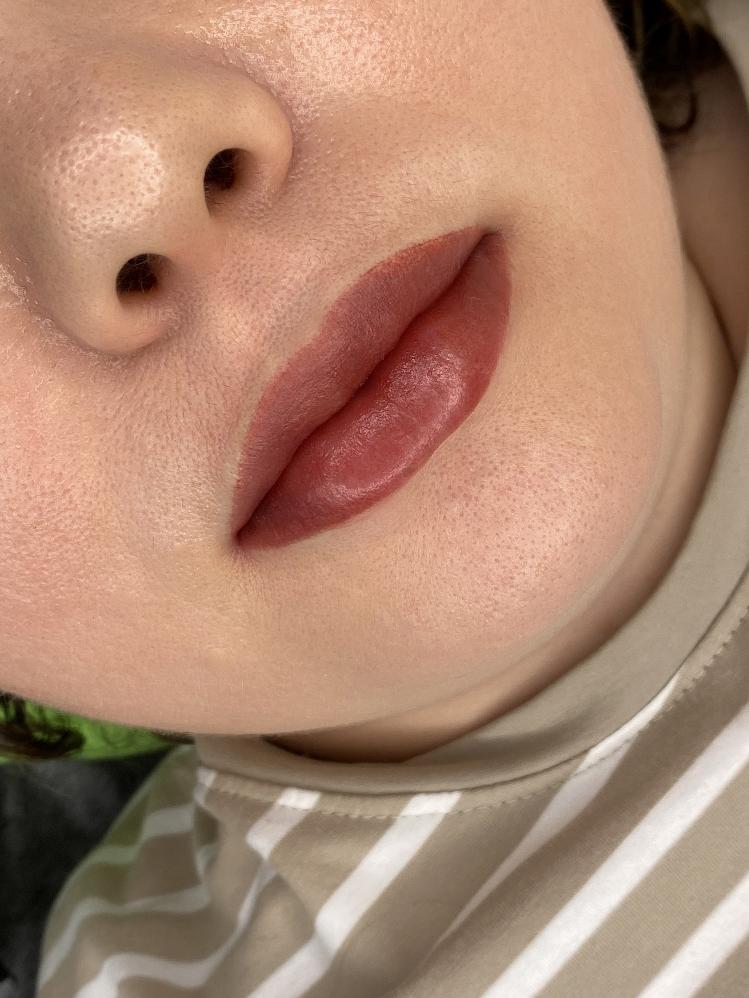 Фото услуги